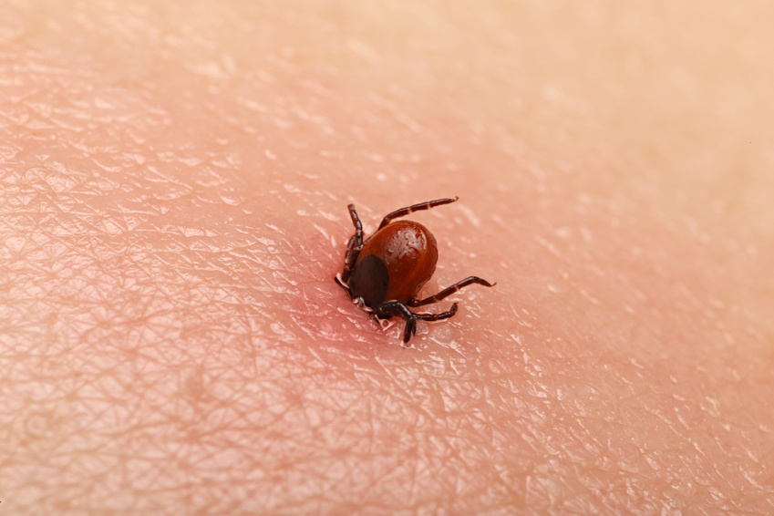 Image Lyme